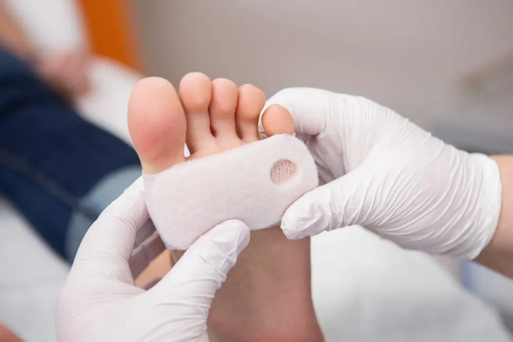 Bilan podologique près de Beaupréau