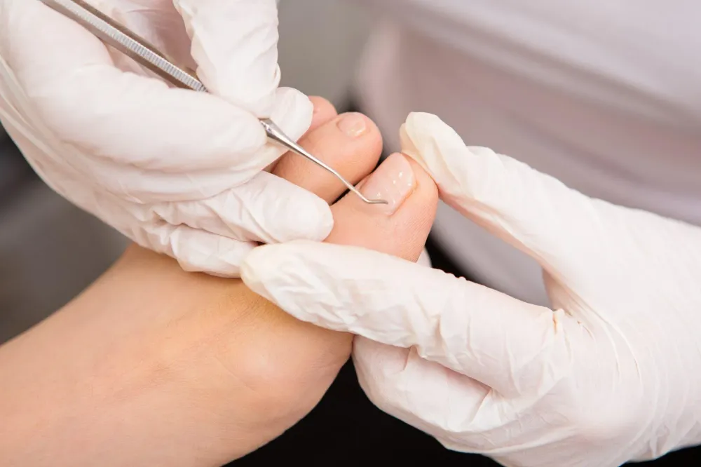 Soins des pieds près de Beaupréau