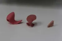 Orthoplasties